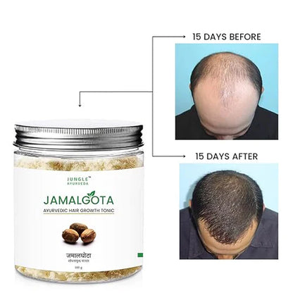 Jamalgota Ayurvedic Hair Growth Powder – 100gm | Natural Hair Regrowth & Scalp Treatment