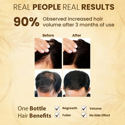 Jamalgota Ayurvedic Hair Growth Powder – 100gm | Natural Hair Regrowth & Scalp Treatment